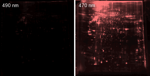 Sypro ruby stained 2D gel