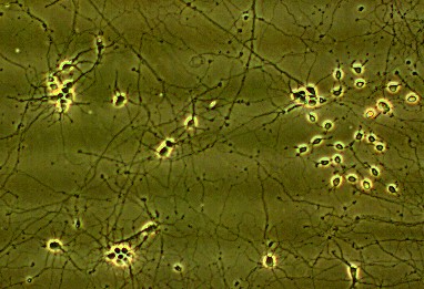 Cultured neuroblastoma cancer cells