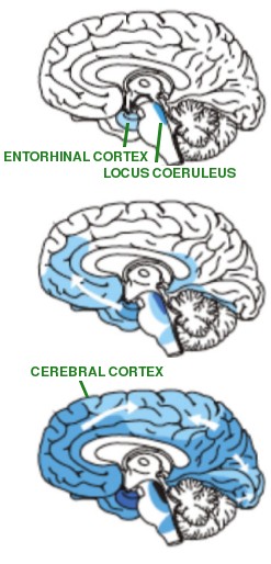 Entorhinal cortex