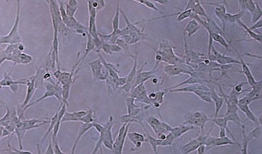 SH-SY5Y neuroblastoma cells