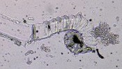 Fiber released from syringe filter