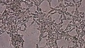 Neuroblastoma Cells